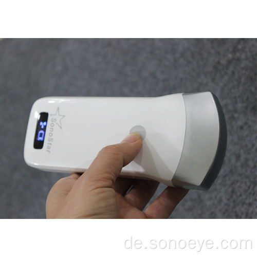 Tragbarer konvexer Mini-Ultraschallscanner